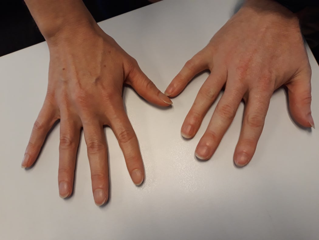 Guitarist's fingernails (Jane Curry and Owen Moriarty)