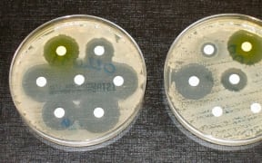 Money for research into discovering a solution for increased antimicrobial resistance is coming from crowdfunding.