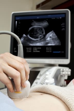 A woman receives an ultrasound during her pregnancy