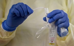 16 November 2020, Berlin:A study assistant, holds a tube with the swab for a PCR test for an antibody study of Robert Koch Institute