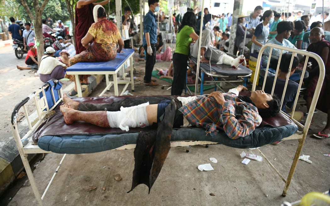 An earthquake survivor lies on a bed in the compound of a hospital in Naypyidaw on March 28, 2025, after an earthquake in central Myanmar. A powerful earthquake rocked central Myanmar on March 28, buckling roads in capital Naypyidaw, damaging buildings and forcing people to flee into the streets in neighbouring Thailand. (Photo by Sai Aung MAIN / AFP)