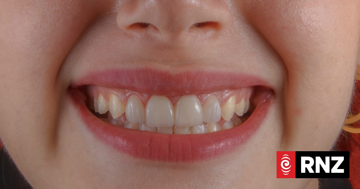 How white should your teeth actually be?