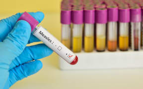 Testing for mumps