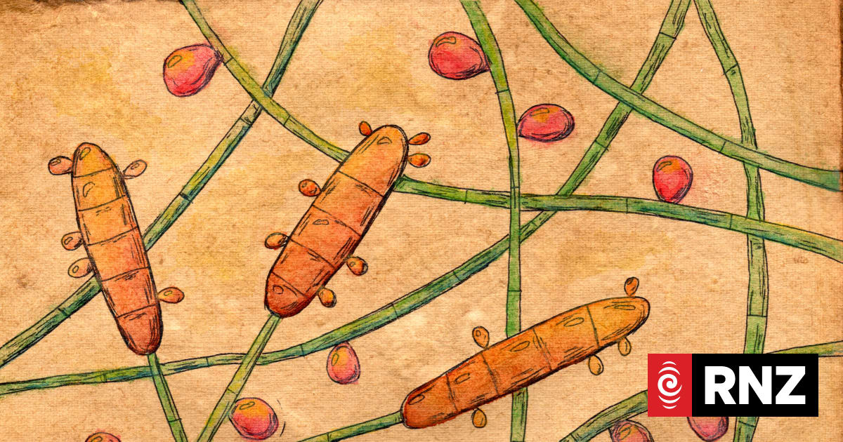 New strain of drug-resistant fungus that causes ringworm found in New ...