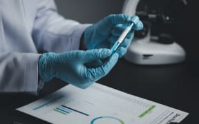 Lab assistant, medical scientist, chemistry researcher holds a glass tube through a chemical test tube, does a chemical experiment and examines a patient's sample. Medicine and research concept.