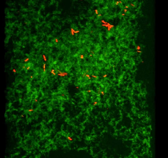 Salmonella bacteria (red) entrapped in a amyloid matrix (green) at an early stage of infection.