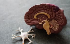 Plastic model of a human brain