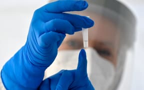 An employee shows a tube with the carrier fluid for a Corona rapid test. F
