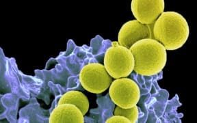 Methicillin-resistant Staphylococcus aureus Bacteria  (yellow) being ingested by neutrophil (purplish blue)