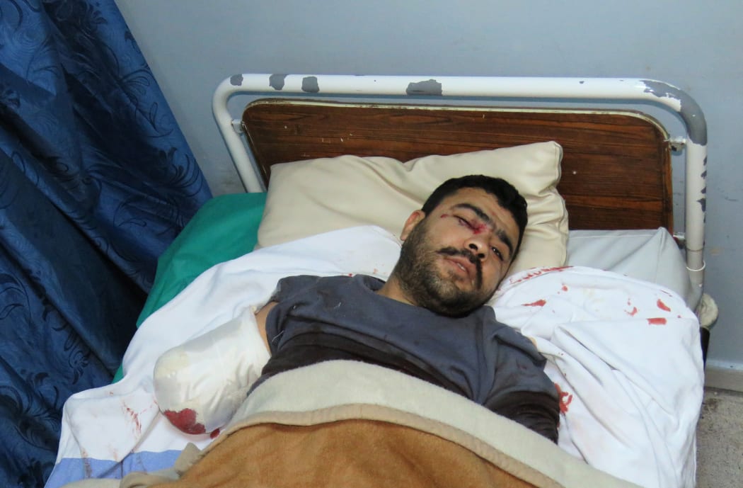 A wounded Syrian man is treated at a hospital in Damascus after being injured when a rocket hit a busy shopping area in the shrinking enclave of Eastern Ghouta.