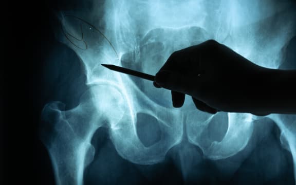 X ray film with doctor's hand to examine