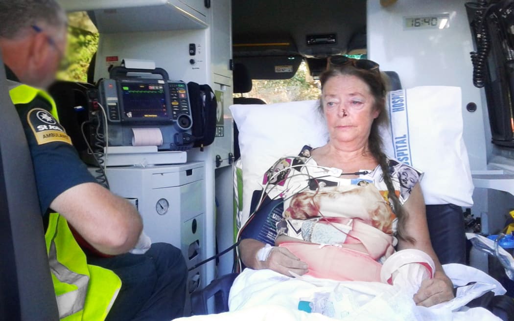 Pamela Coleman says she suffered broken ribs, a concussion, and had glass in her knees after the accident.