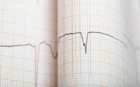 A 4.8 earthquake has been recorded, centred south of Porangahau, at a depth of 15km.