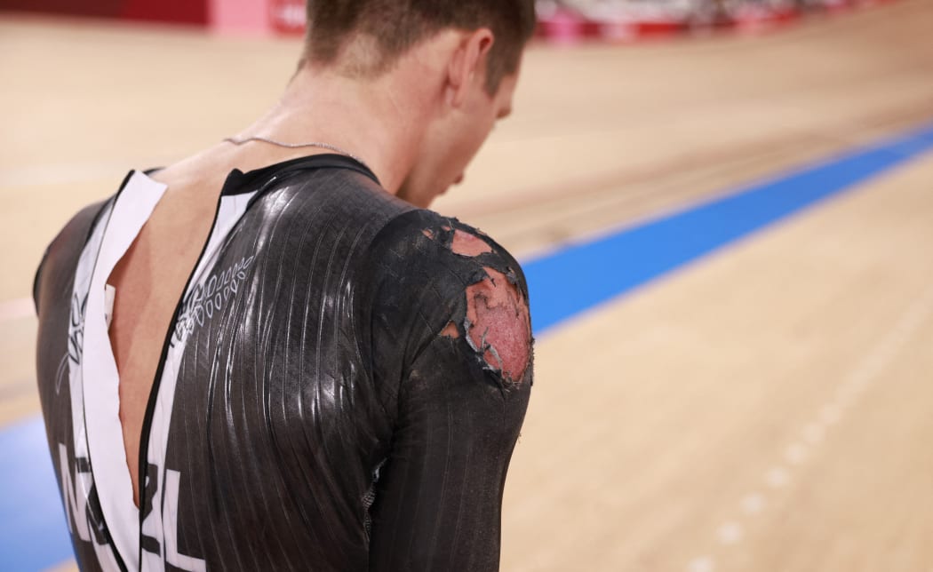 New Zealand's Aaron Gate's scraped shoulder is seen after he crashed while competing in the men's track cycling team pursuit finals during the Tokyo 2020 Olympic Games at Izu Velodrome in Izu, Japan, on August 4, 2021.