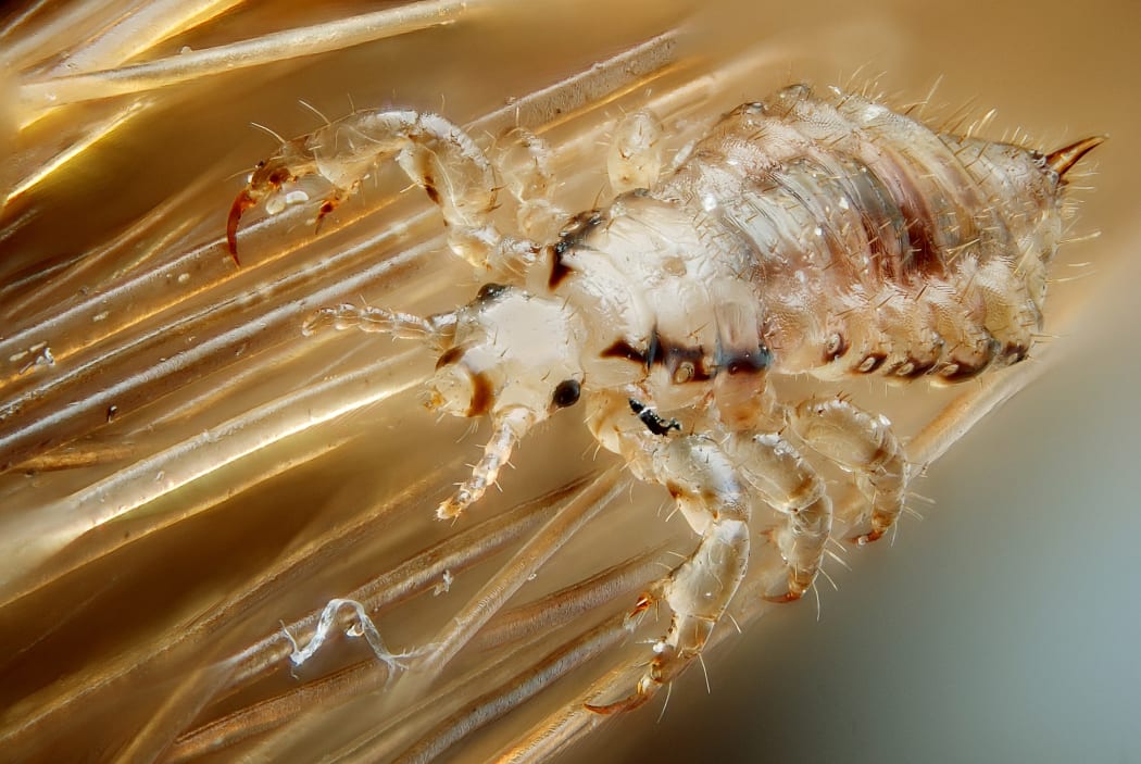 Male headlouse on a human head