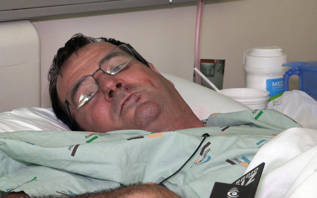 Truck driver Brendon Greig at Auckland Hospital after smashing through a motorway barrier near Auckland's Spaghetti Junction.