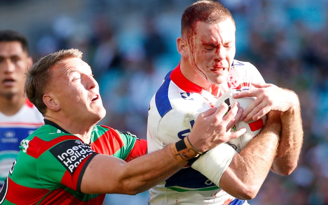 Rocco Berry with a head cut. South Sydney Rabbitohs v One NZ Warriors.