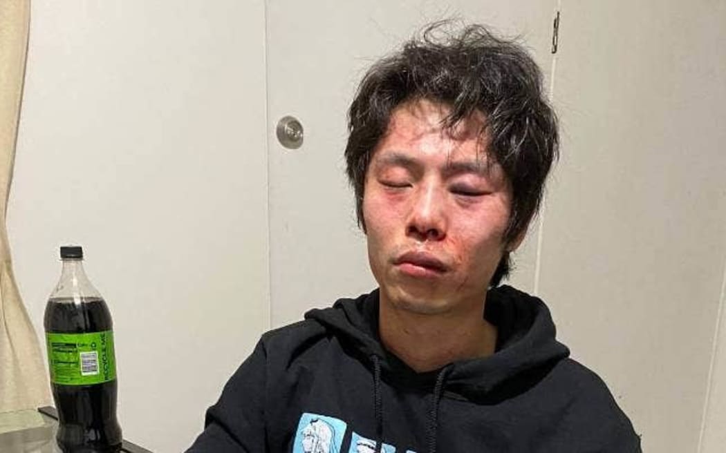 Peng Cao pictured after the fight with his landlords.