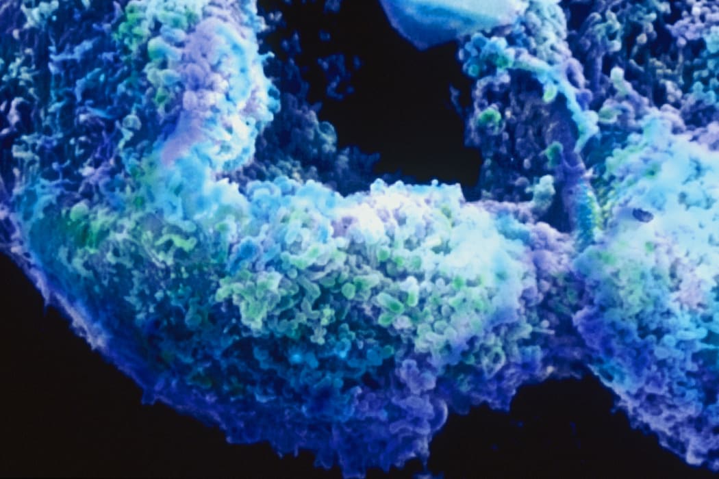 Chlamydia are very small (0.3 micron), gram-negative bacteria, which can only multiply within a host cell.