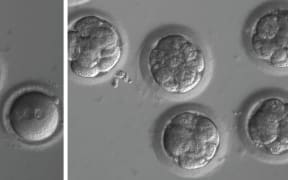 Newly fertilised eggs before gene editing, left, and embryos after gene editing and a few rounds of cell division.