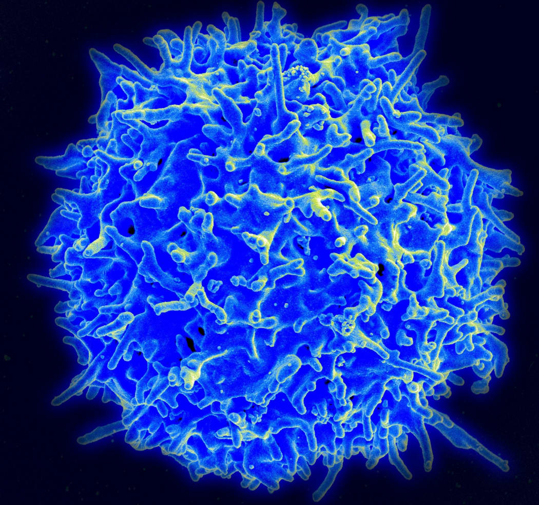 Scanning electron micrograph of a human T lymphocyte (also called a T cell) from the immune system of a healthy donor.
