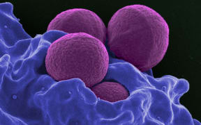 Human neutrophil ingesting Methicillin-resistant Staphylococcus aureus (MRSA), a bacteria that is resistant to many antibiotics.
