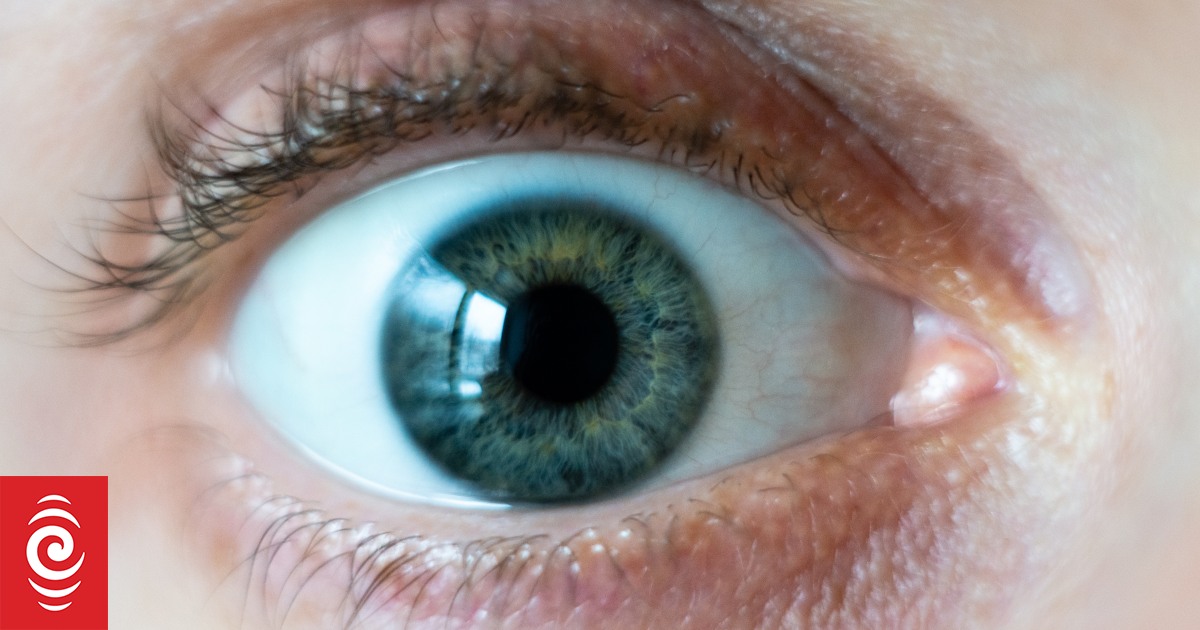 Auckland team uses umbilical stem cells to treat eye disease