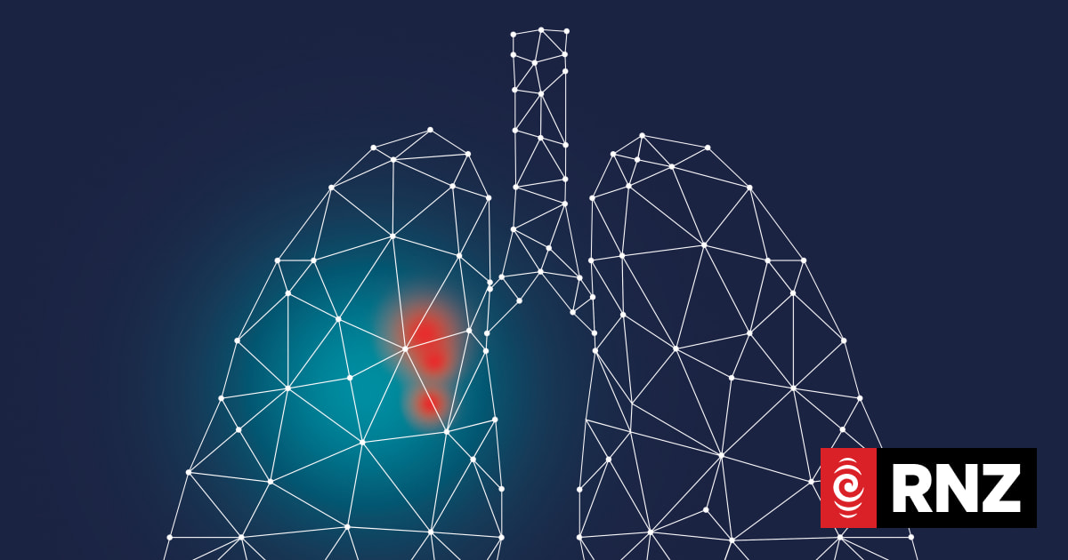 Calls for next government to fund lung cancer screening