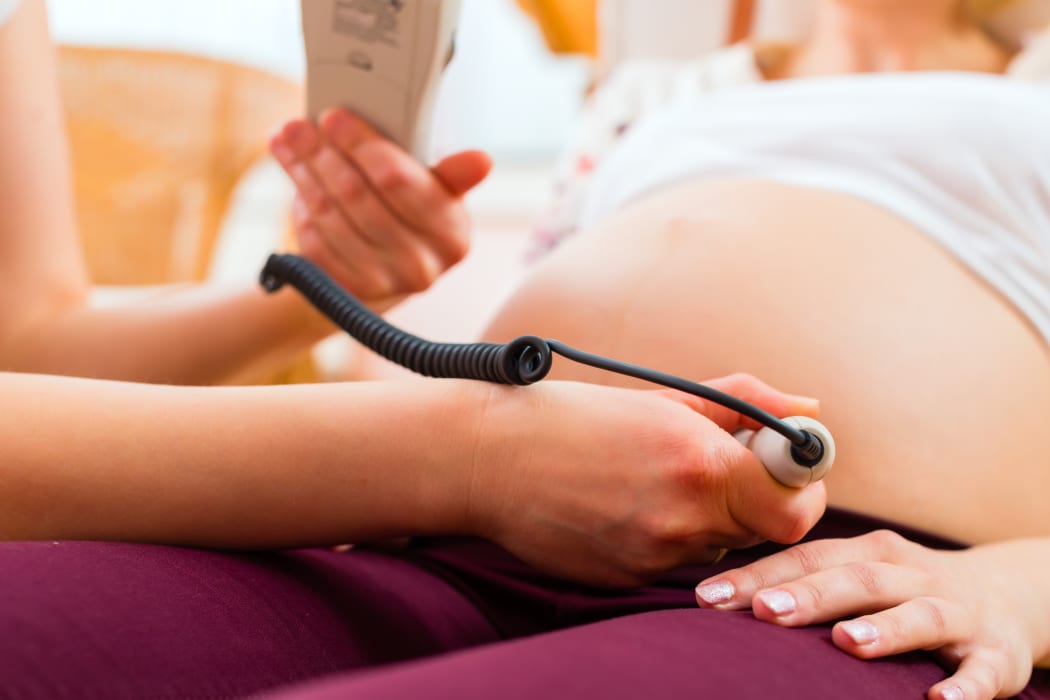 A file photo shows a midwife with a pregnant woman.