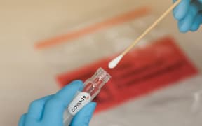 COVID-19 Nasal swab laboratory test in hospital lab