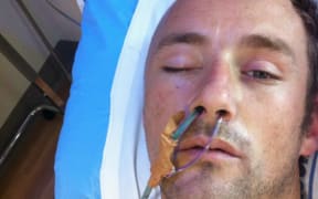 Benjamin Lightbody in hospital after the attack in Mt Eden prison in 2013.