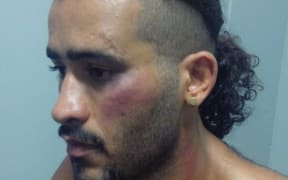 Iranian asylum seeker on Manus
