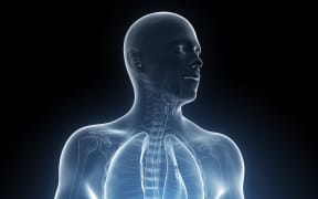 Pancreatic cancer