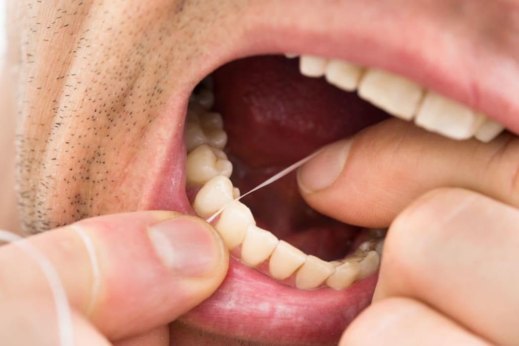 The New Zealand Dental Association will review its flossing guidelines after the US government dropped the practice from its dietary recommendations.