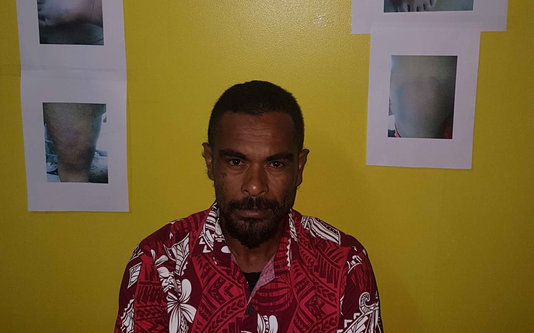 On the the alleged police brutality victims.On the the alleged police brutality victims.