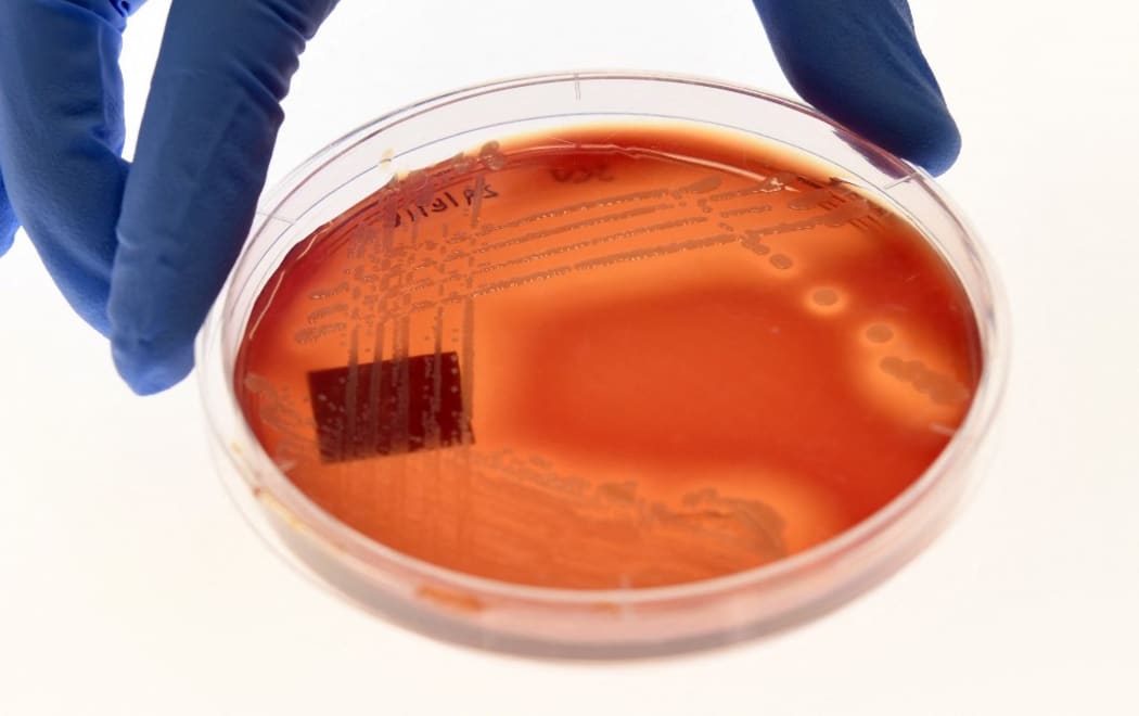 A superbug resistant to all known antibiotics that can cause "severe" infections or even death is spreading undetected through hospital wards across the world,