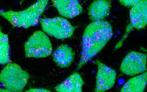 Cancer cells (green) taking up nanoparticles (red), demonstrating how cancer drugs could be delivered more effectively