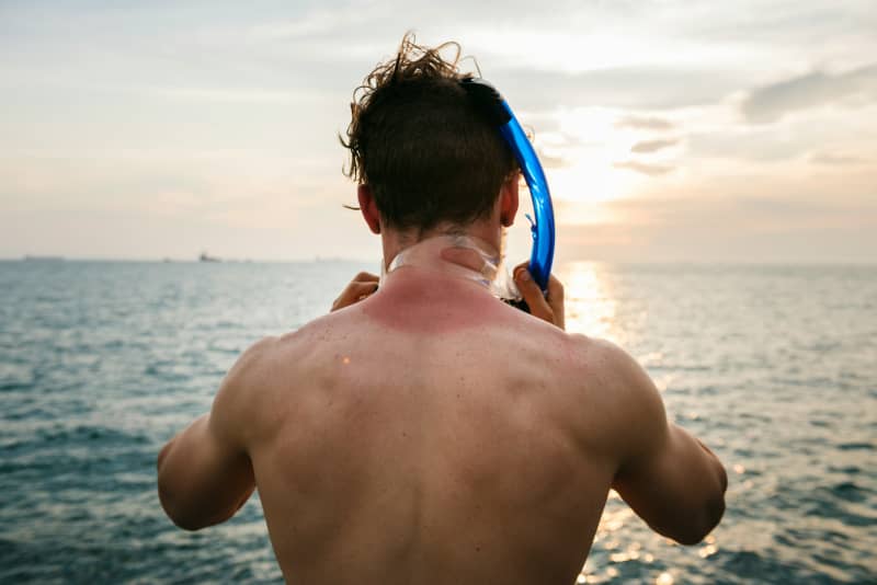 Man with sunburnt neck in the sea prepares to snorkel.