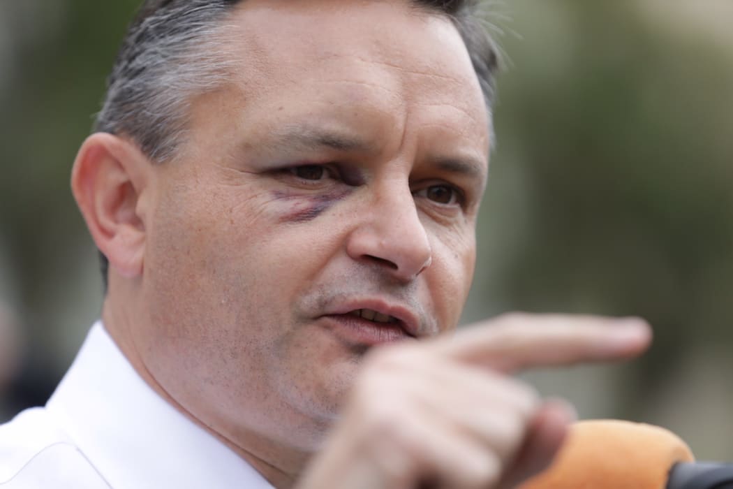 Greens Party co-leader James Shaw appeared with his black eye at the climate change strike in Wellington.