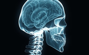 X-ray of a human skull, brain and spine