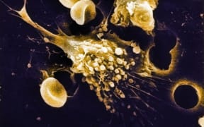 A scanning electron microscope (SEM) image of a cancer cell.