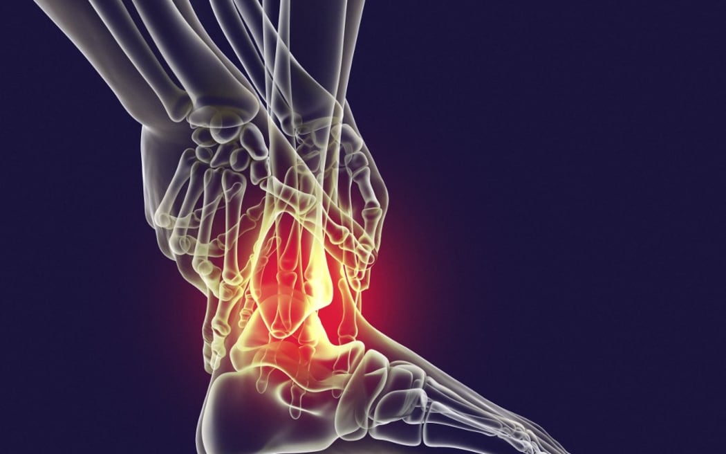 Man with foot pain and highlighted skeleton, computer illustration. (Photo by KATERYNA KON/SCIENCE PHOTO LIBRA / KKO / Science Photo Library via AFP)