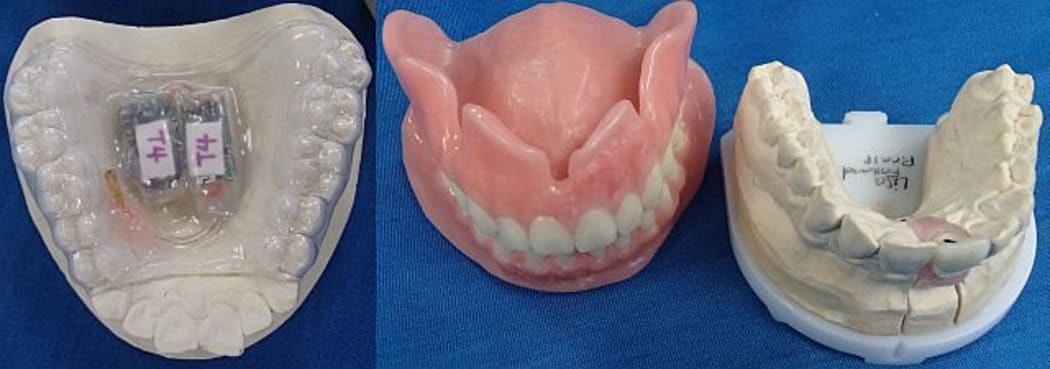 The device at left is a device that has been moulded to fit one person's teeth, and contains sensors to detect pH in the mouth over 24 hours. At right is an example of a full set of dentures and a single tooth cap,