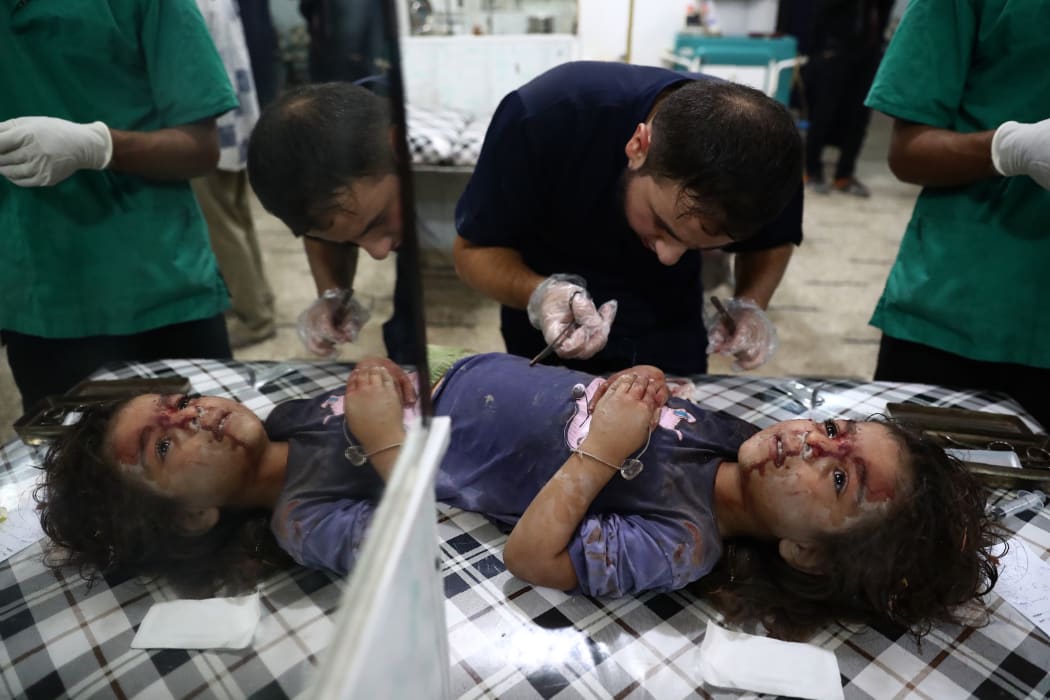 A child receives medical treatment after an air strike in Douma on the outskirts of Damascus, Syria.