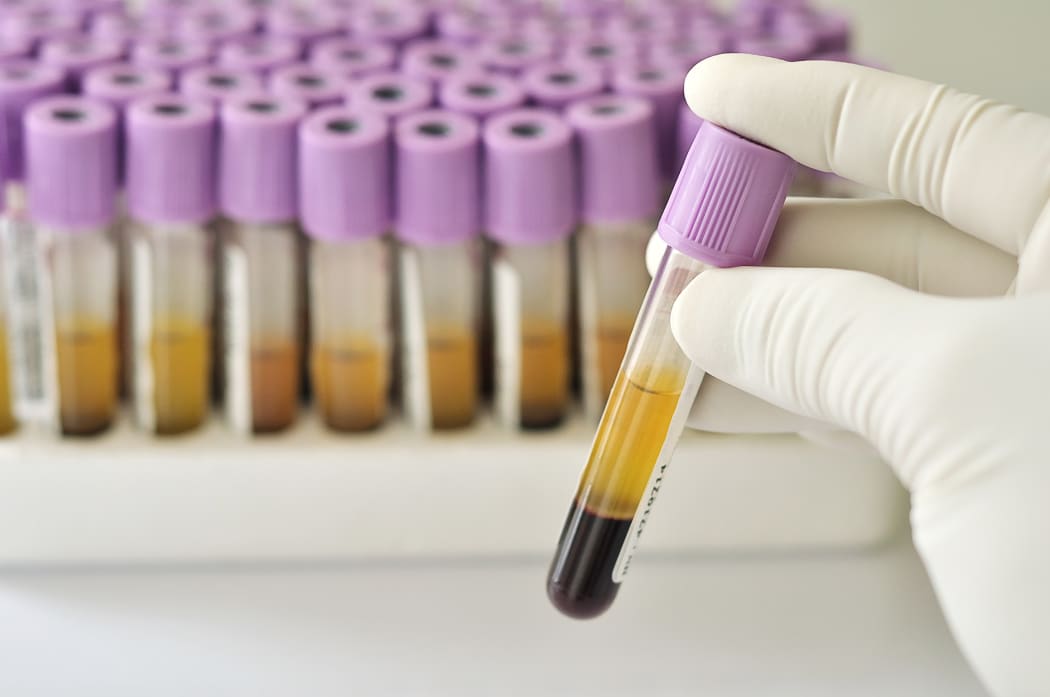blood tests