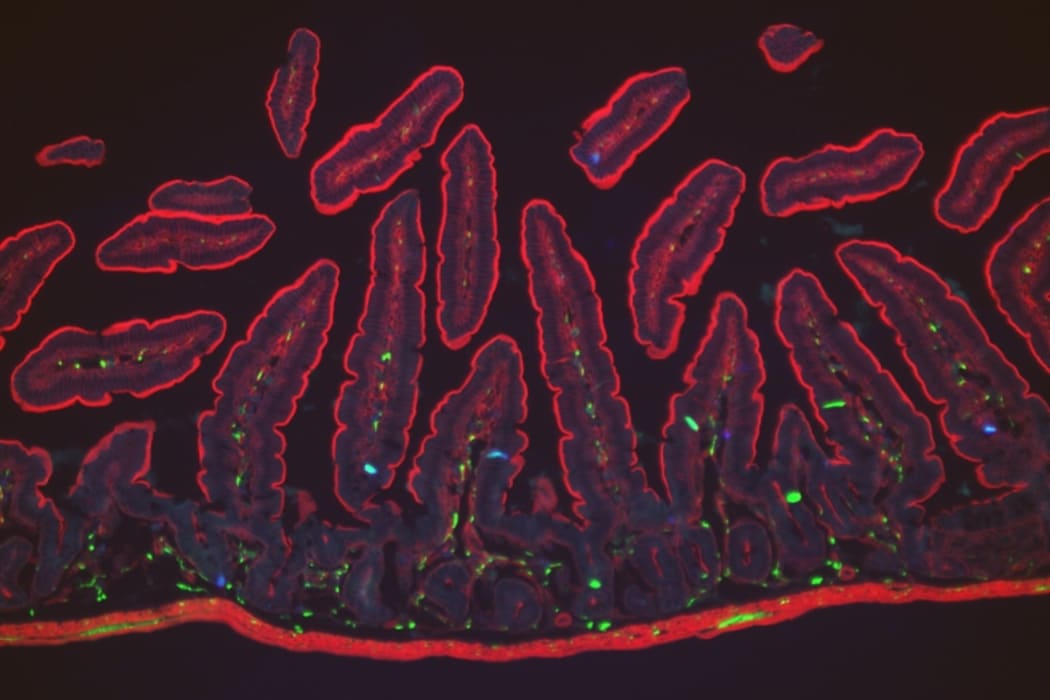 Enterochromaffin cells (blue) in finger-like projections within the gut villi (outlined in red) detect noxious chemicals.