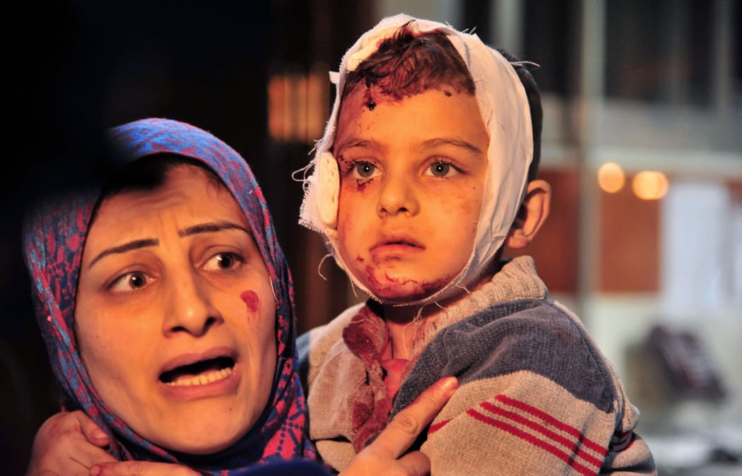 Wounded Syrian at a hospital in the Syrian capital Damascus folling bomb blasts.