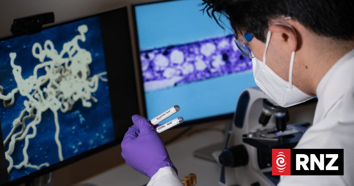 Fewer Kiwis contracting sexually transmitted diseases