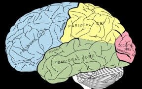 Because the temporal, occipital, and parietal lobes are so close, electrical activity can easily travel between them
