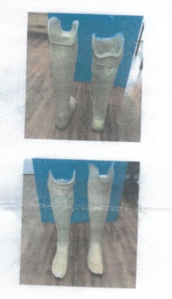Jan Hansen's artificial legs.